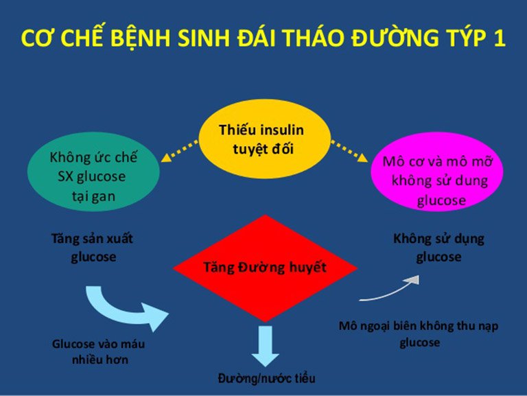 Cơ chế bệnh sinh đái tháo đường tuýp 1